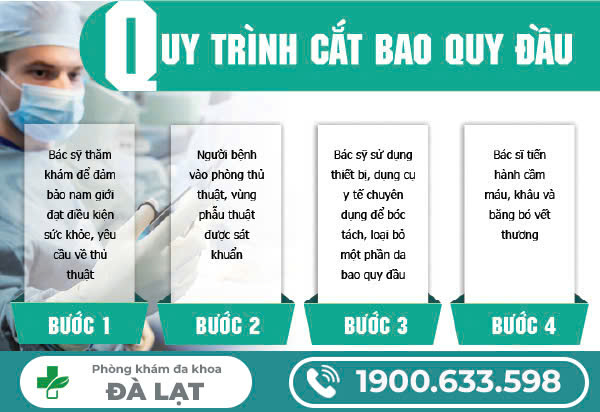 Hình ảnh minh họa